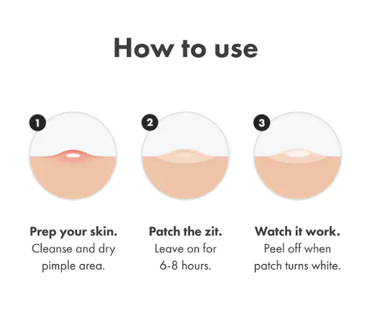 Miracle Chin Acne Repair Patch Day & Night (36/72 Patch Box)